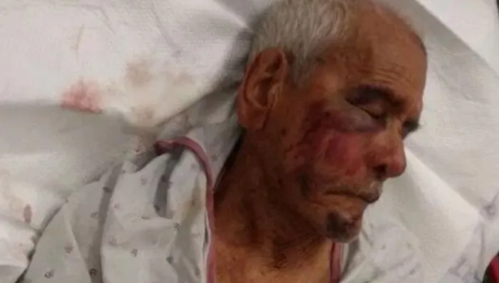 A woman, Laquisha Jones was arrest for the assault of Rodolfo Rodriguez on July 10, 2018. (GoFundMe)

