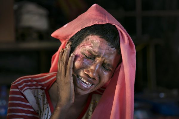 A Rohingya woman recounts the horror of being raped and set on fire by Burmese soldiers