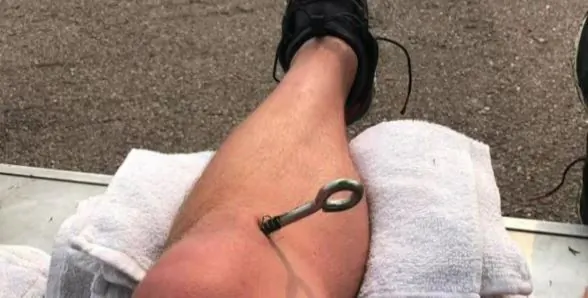 Colorado Golfer’s Leg Impaled by Large Bolt in Freak Accident