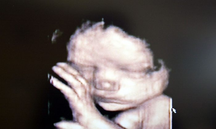 A 3D ultrasound showing a baby inside the womb.  (Fotopress/Getty Images)