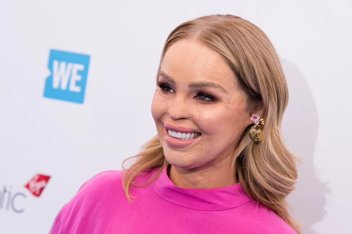 Katie Piper, who was scarred in an acid attack, attends an event at Wembley Arena in London, on March 7, 2018. (Jeff Spicer/Getty Images)