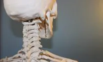 Opioids Use for Osteoarthritis Has Little Benefit and Increased Risk of Adverse Events, Experts
