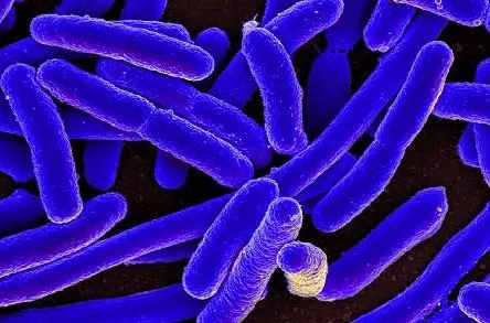 132,000 Pounds of Ground Beef Recalled After 17 People Get Sick