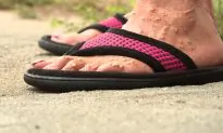Stranger Saves Woman Dying From Ant Bites