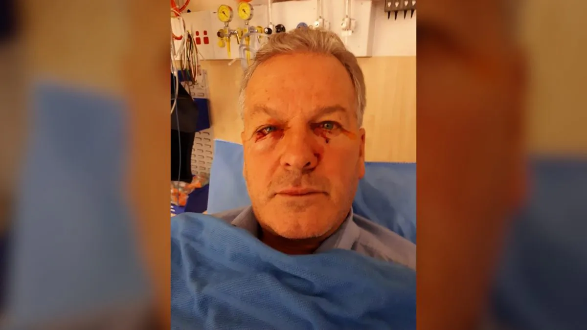 Billy Willox in hospital after being attacked by a kangaroo he was checked up on in Googong, ACT, in Sept. 2018. (Kerrie Venables/Facebook)