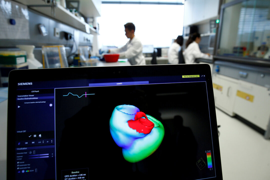 A monitor shows a three-dimensional image of a human heart at the Klaus-Tschira-Institute for Integrative Computational Cardiology, department of the Heidelberg University Hospital (Universitaetsklinikum Heidelberg), in Heidelberg, Germany, Aug. 14, 2018. (Ralph Orlowski/Reuters)
