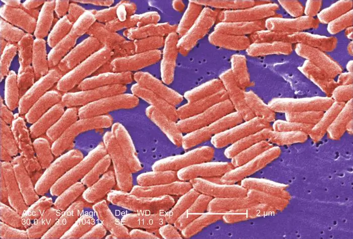 Gram-negative rod-shaped Salmonella bacteria. (Public Health Image Library (PHIL)/WikiDoc)