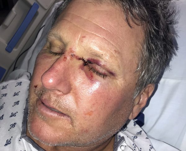 Bob Legasa in hospital