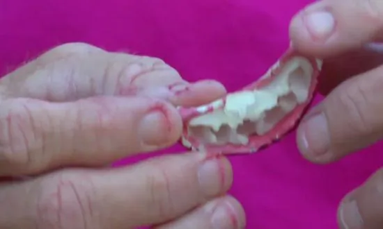 Alabama Woman’s Halloween Costume Turns Into Medical Ordeal After Fake Teeth Get Stuck