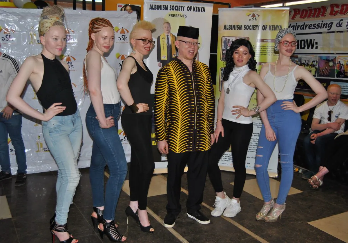 Sen. Isaac Mwaura (2-R) poses for a photo on Oct. 27, 2018, with female contestants that will represent Kenya in the battle for Mr. & Miss Albinism East Africa. (Dominic Kirui/Special to The Epoch Times)