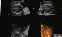Georgia House Panel Approves Pro-Life ‘Heartbeat’ Bill