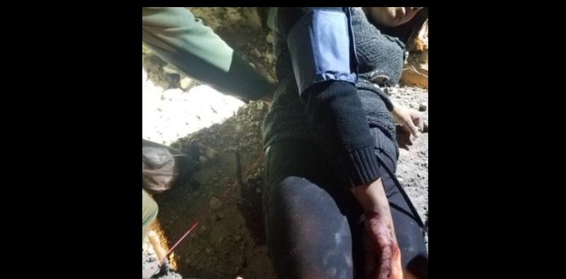 injured migrant in new photo