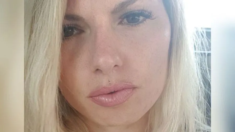 A mother of three died from a blood clot nearly three weeks after she got a plastic surgery procedure at a clinic in London. (Louise Harvey / Facebook selfie)
