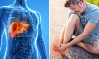 6 Dangerous Symptoms That Indicate Your Liver Might Be Loaded With Toxins