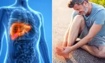 6 Dangerous Symptoms That Indicate Your Liver Might Be Loaded With Toxins