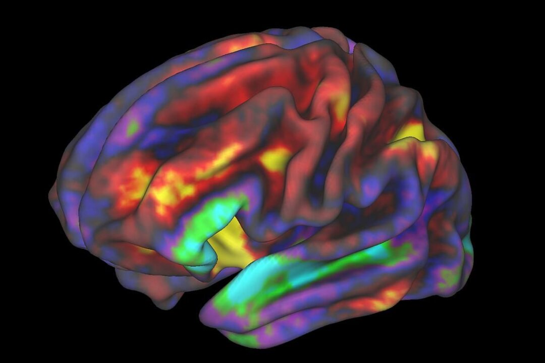 fMRI image of preteen brain while child performs a working memory task, released by ABCD researchers. The regions in yellow and red are most active. (Richard Watts, PhD, University of Vermont and Fair Neuroimaging Lab, Oregon Health and Science University)