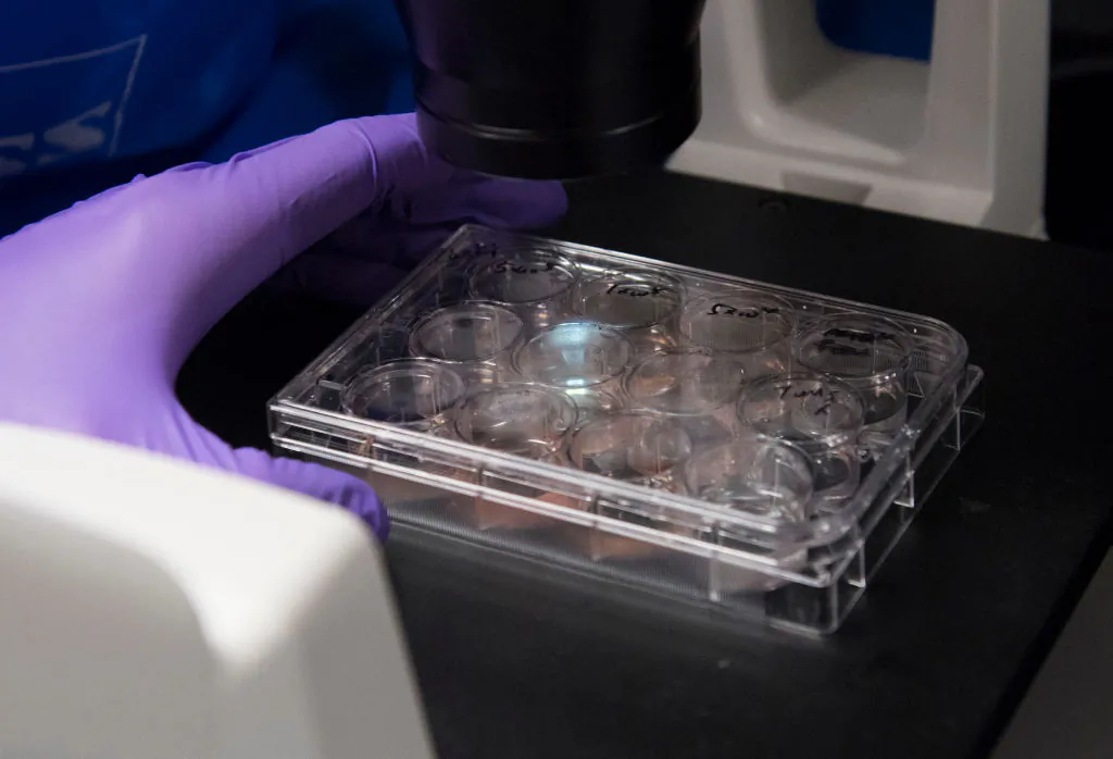 Dr. Benjamin Jin, a biologist working on immunotherapy for HPV+ cancers, works in the lab of Dr. Christian Hinrichs, an investigator at the National Cancer Institute at the National Institutes of Health (NIH) in Bethesda, Md., Feb. 7, 2018.
(SAaul Loeb/AFP/Getty Images)