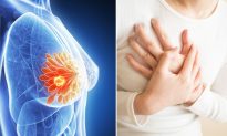 Breast Cancer Drug for Reducing Recurrence Risk Approved for Australia