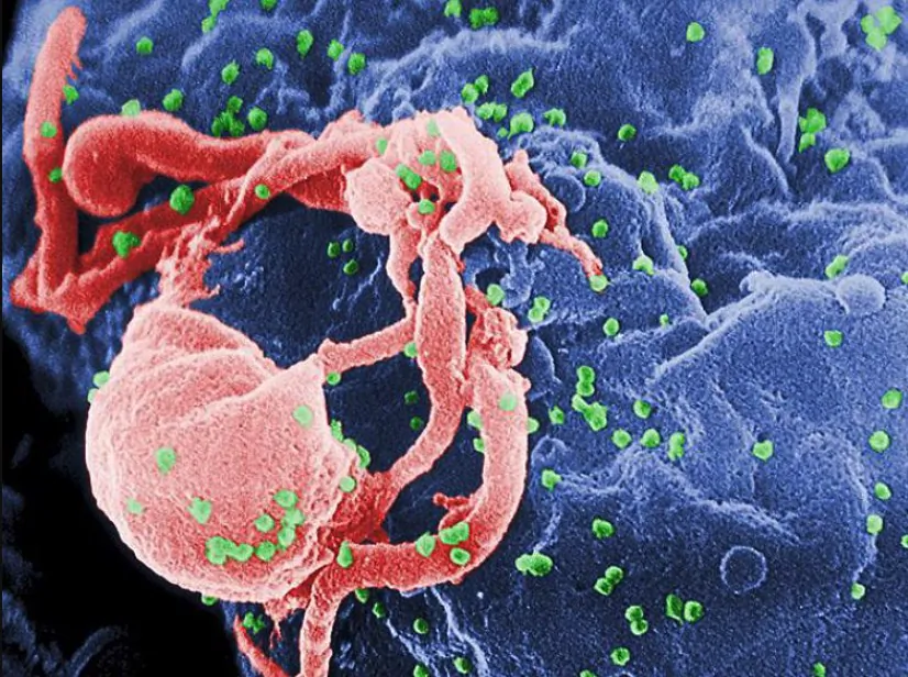 Undated file photo showing an electron micrograph of HIV-1 (in green) budding from cultured lymphocyte. (Public domain)