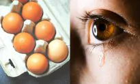 Teen Could Not See After Microwaved Egg Exploded in Face