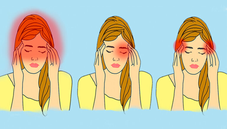 Headaches Are of Different Types and Each Has Some Health Reasons, Find Out More