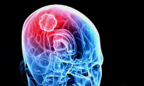 Nurse Diagnoses Her Own Brain Tumor in 2018 After Seeing Poster at Work