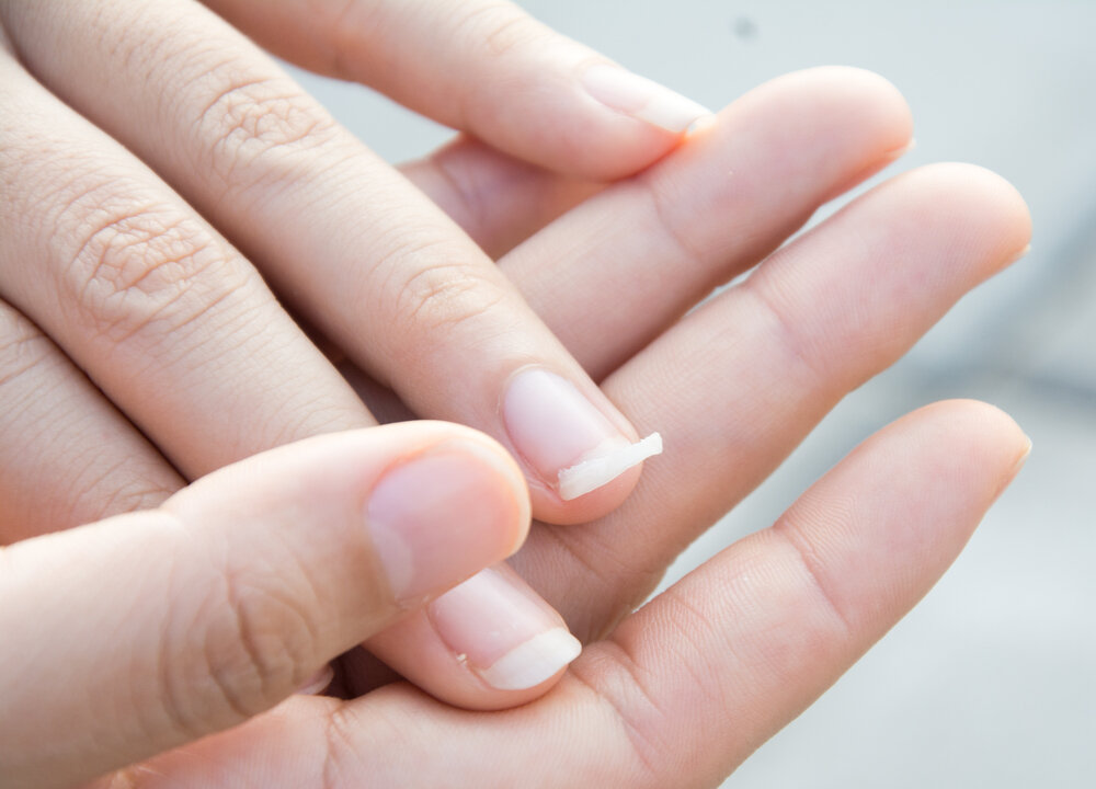 A stock photo of fingers (Tushchakom/Shutterstock)