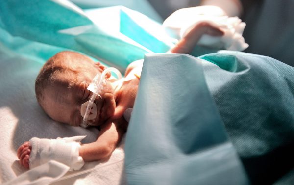 premature baby