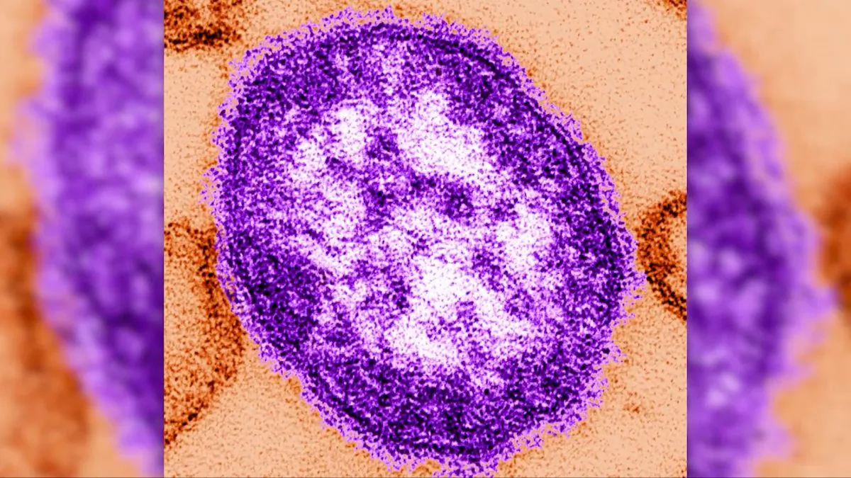 Pictured here is the measles virus, paramyxoviridae from the Morbillivirus family. (Screenshot/CNN)