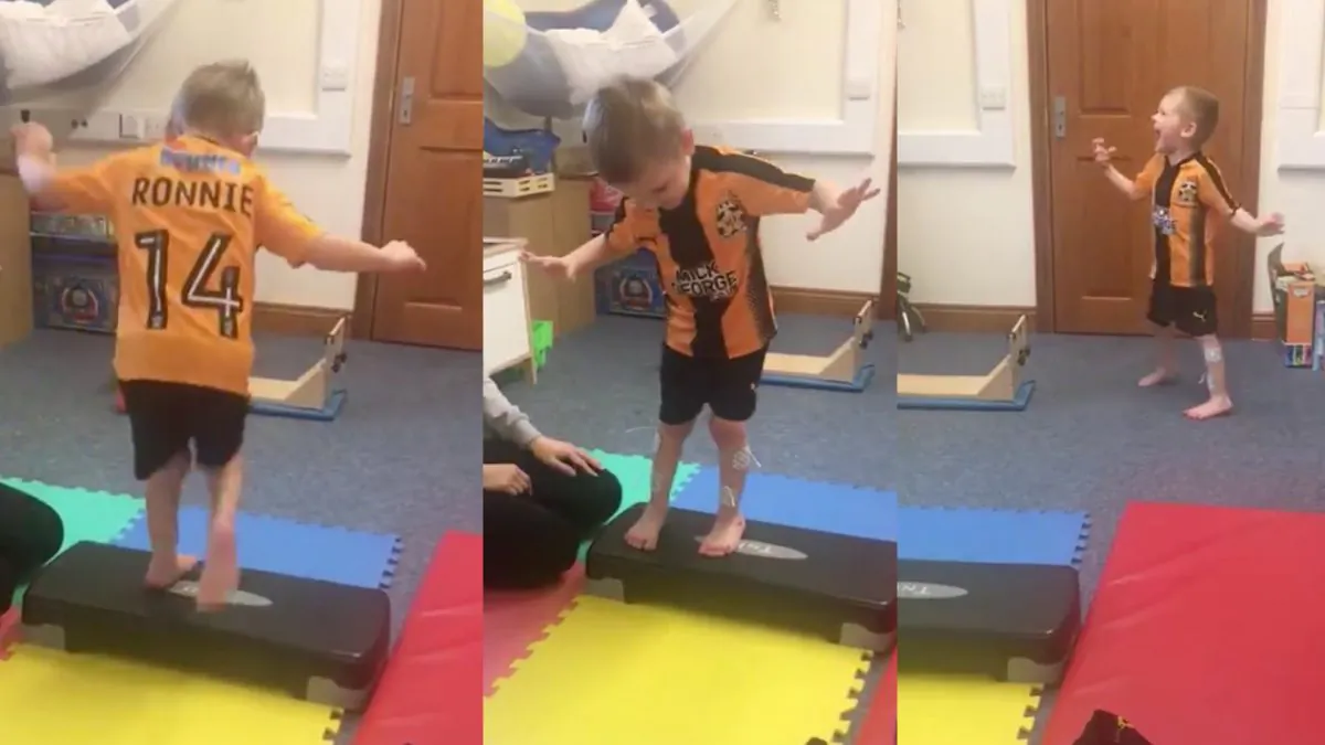 Ronnie Leys from Saffron Walden, Essex walked his first steps without splints after an operation. His father captured it in an inspiring video that went viral on Twitter. (Steve Leys/Twitter)