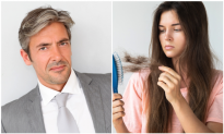 8 Things Your Hair Says About Your Health—#8 Can Cause Early Graying