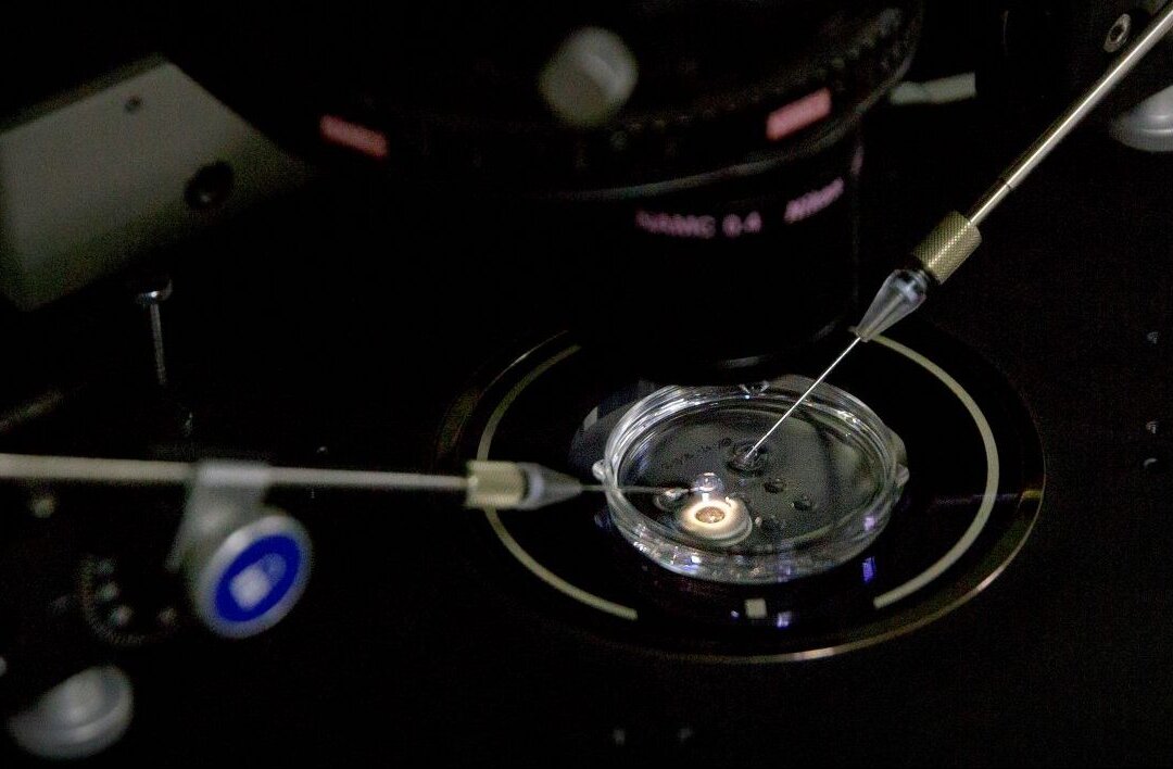 An embryo receives a small dose of Cas9 protein and PCSK9 sgRNA in a sperm injection microscope in a laboratory in Shenzhen in southern China's Guangdong province. (AP Photo/Mark Schiefelbein)