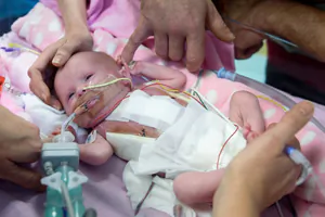 Baby Born With Heart Outside Her Chest Heads Home Against the Odds