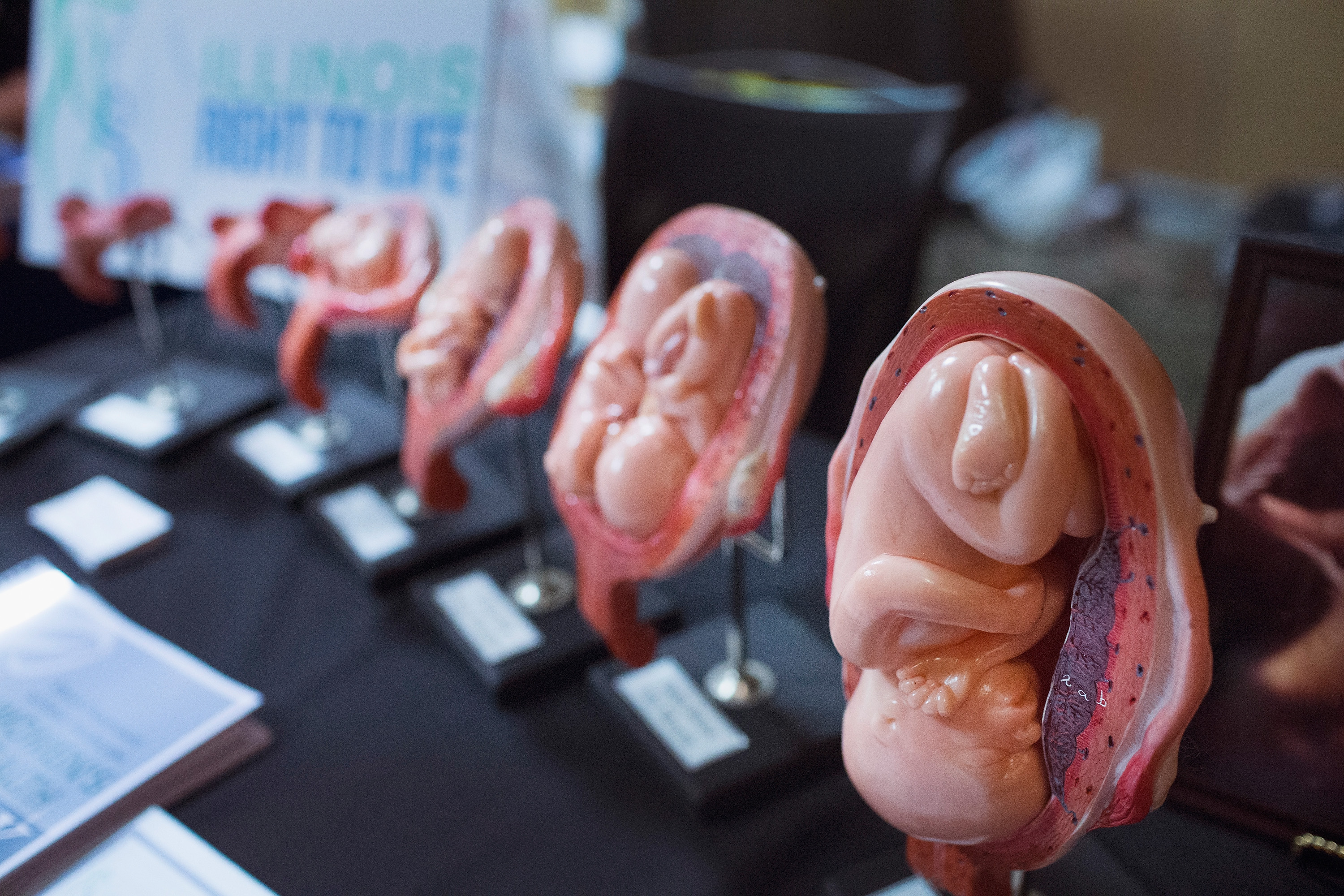 Stages of a fetus are displayed at the Illinois Right To Life a table 