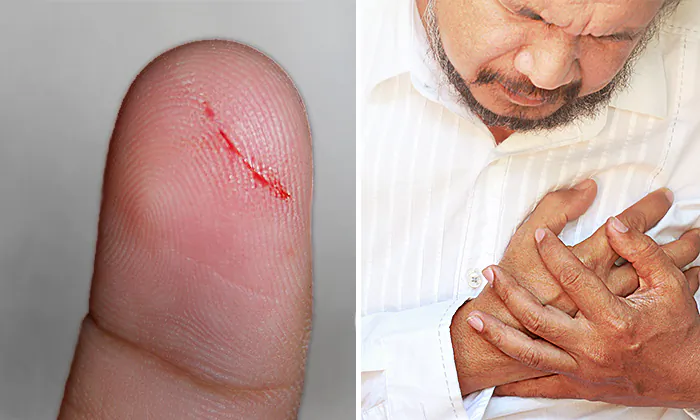 10 Signs of Poor Blood Circulation: Are Your Papercuts Taking WAY Too Long To Heal?