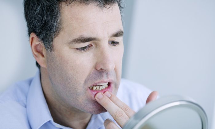 Lack of Vitamin D Associated With Dental Cavities in Older Adults: Study