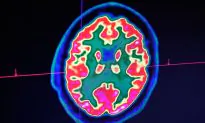 Scientists Claim They May Have Discovered the Cause of Alzheimer’s