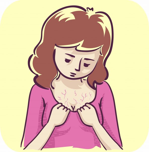 Woman Looking at Veins on Her Breasts