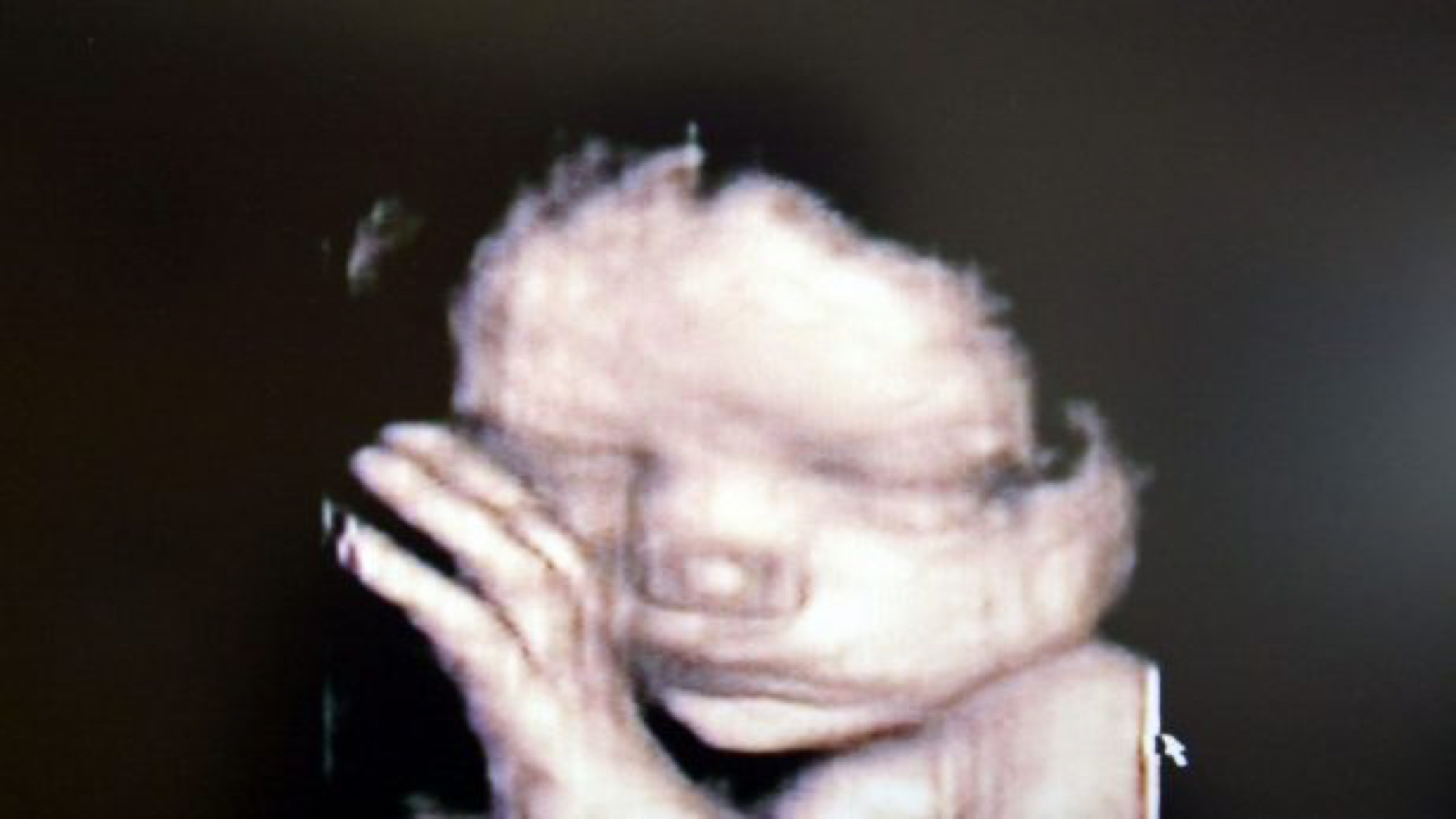 Texas City Becomes Latest to Ban Abortion, Passes 'Sanctuary for the Unborn' Ordinance - Vimarsana News