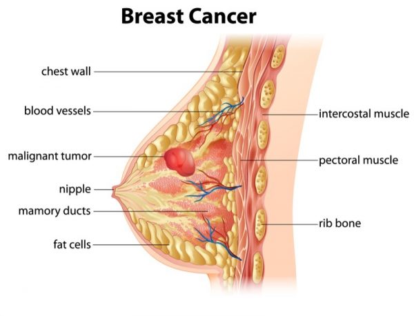 What Does Itchy Breast Mean