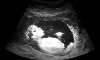 Federal Judge Blocks Mississippi ‘Heartbeat’ Abortion Ban, Governor Responds