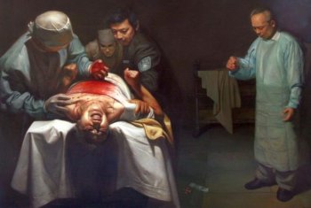 'Organ Crimes.'