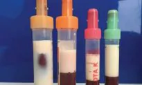Man’s Blood Turns Milky After Poor Diet and Uncontrolled Diabetes Take Toll