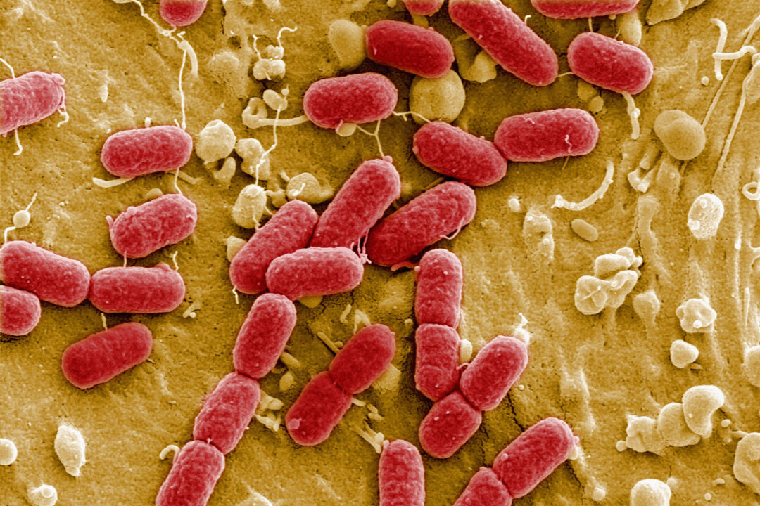 An EHEC bacteria is visible in Berlin, Germany on May 30, 2011. (Courtesay Manfred Rohde, Helmholtz-Zentrum fuer Infektionsforschung (HZI)/Getty Images)