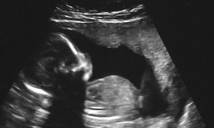 US Government Extends Contract for Mice ‘Humanized’ With Aborted Organ Tissue