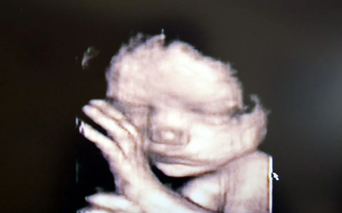A 3D ultrasound showing a baby inside the womb.  (Fotopress/Getty Images)