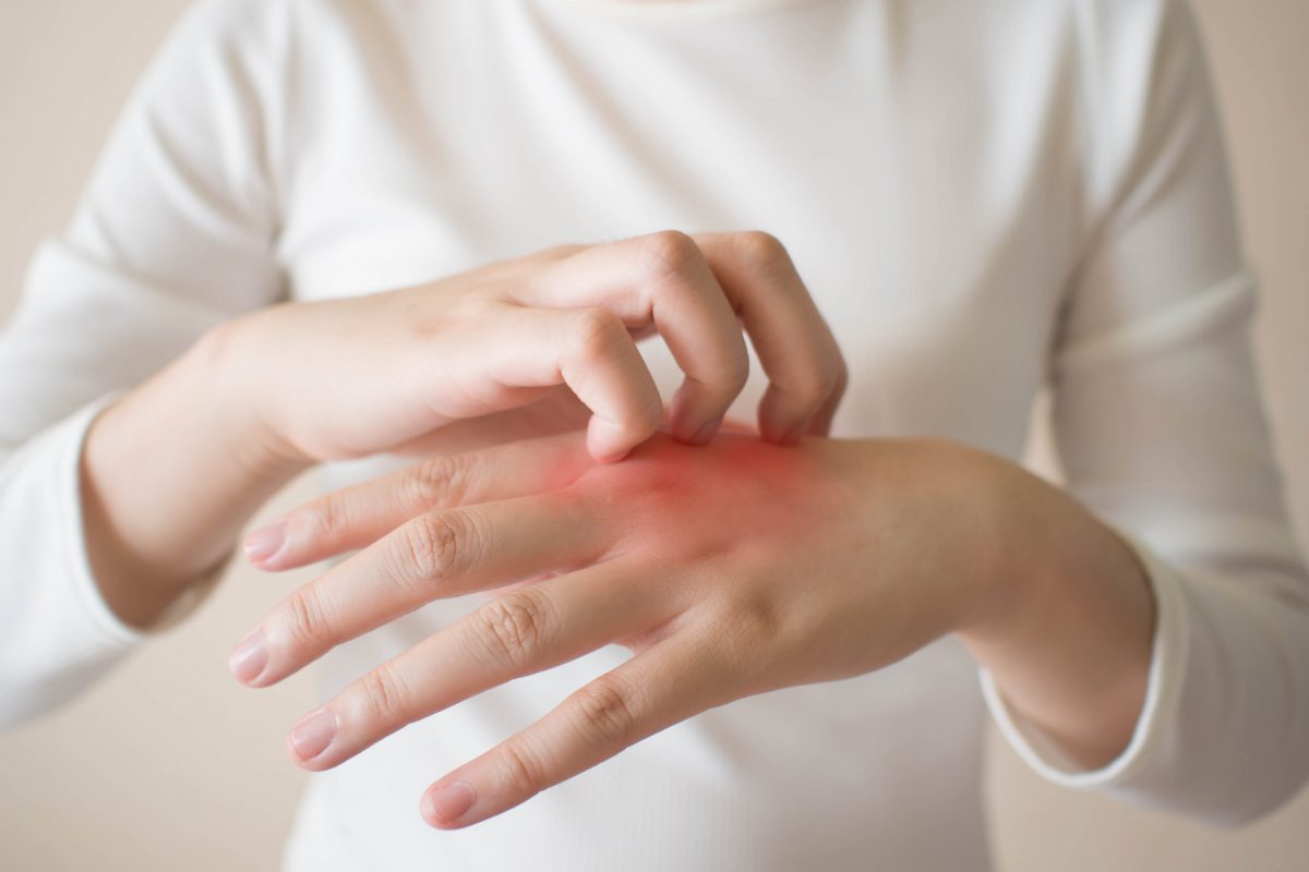 Itchy skin could indicate liver disease, kidney failure, and thyroid problems. (Orawan Pattarawimonchai/Shutterstock)