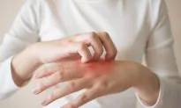 11 Things Your Skin Says About Your Health—Does Your Skin Feel Itchy All The Time?