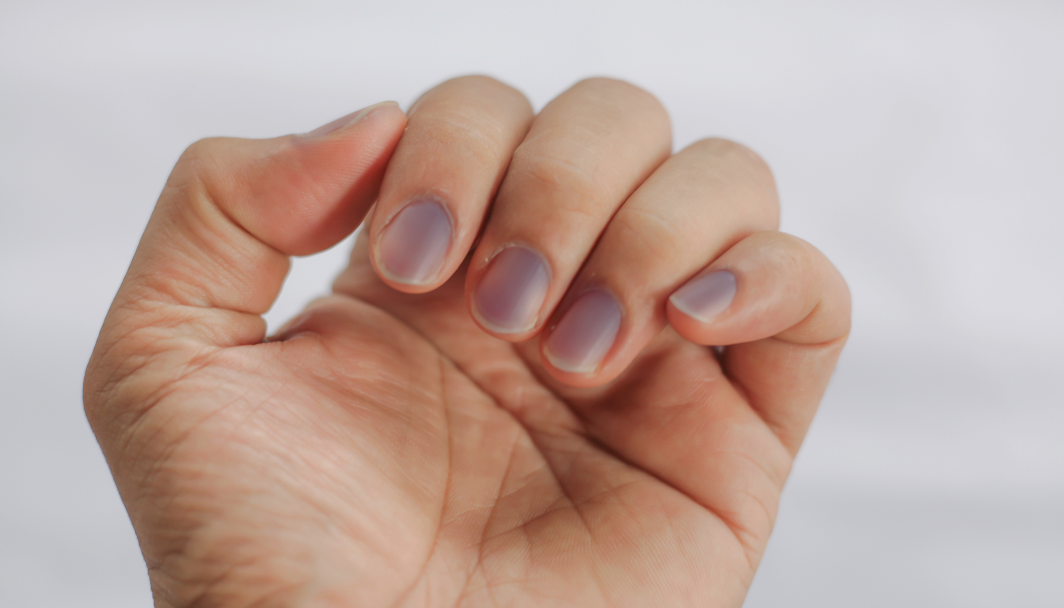 Signs of Health Problems Based on Nail Bed Color - wide 2