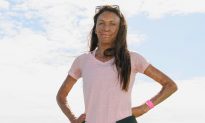 True Love Story of a Former Model Who Suffers Burns on Two-Thirds of Her Body